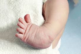 Pediatric Orthopedics