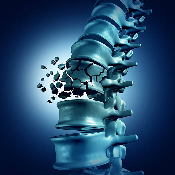 Spine Care